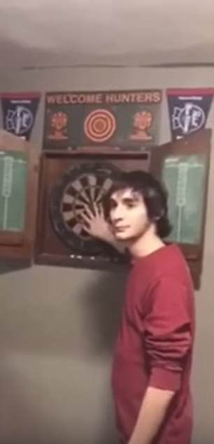 A drunk man dared his drunk friend to throw a dart at the board while he covered the bullseye with the hand